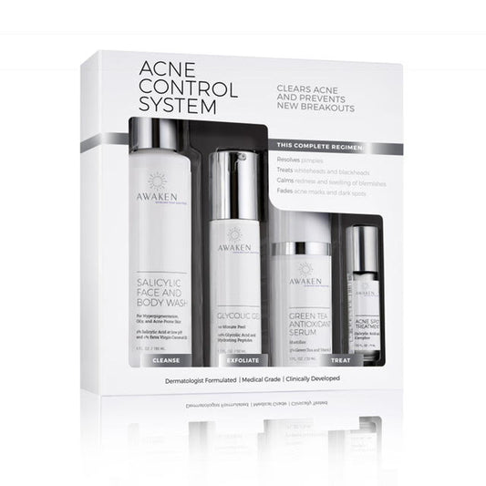 Acne Control System